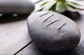 Acupuncture: Relieve Pain and Stress